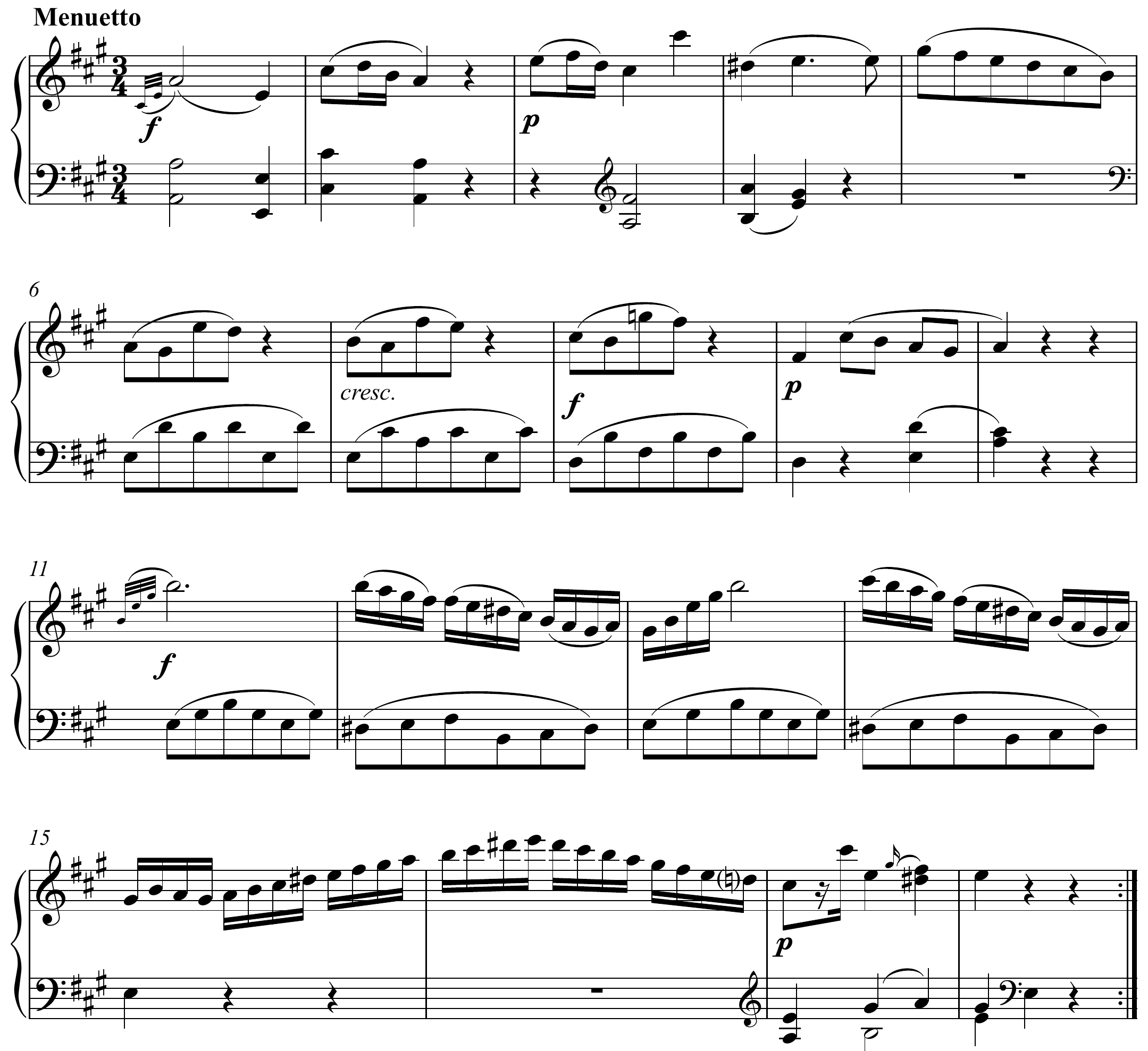 Wolfgang Amadeus Mozart Sonata in A Major, KV 331 Altered score page 1